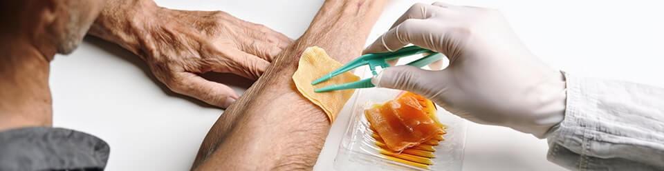 wound healing